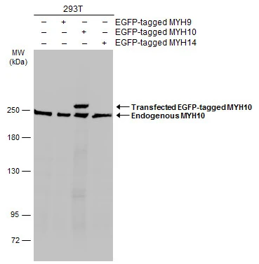 Non-transfected (–) and transfected (+) MYH10-transfected 293T (30 μg) were separated by 5% SDS-PAGE, and the membrane was blotted with MYH10 antibody (GTX133378) diluted at 1:5000. The HRP-conjugated anti-rabbit IgG antibody (GTX213110-01) was used to detect the primary antibody.
