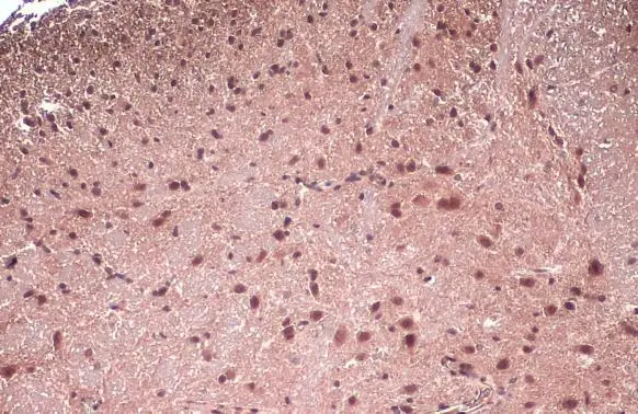 FOXP1 antibody detects FOXP1 protein at nucleus by immunohistochemical analysis. Sample: Paraffin-embedded mouse spinal cord. FOXP1 stained by FOXP1 antibody (GTX133394) diluted at 1:500. Antigen Retrieval: Citrate buffer, pH 6.0, 15 min FOXP1 antibody detects FOXP1 protein at nucleus by immunohistochemical analysis. Sample: Paraffin-embedded mouse spinal cord. FOXP1 stained by FOXP1 antibody (GTX133394) diluted at 1:500. Antigen Retrieval: Citrate buffer, pH 6.0, 15 min