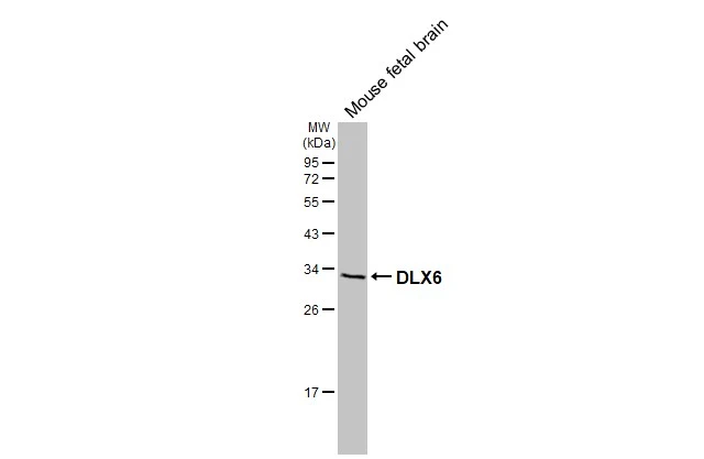 Mouse tissue extract (50 μg) was separated by 12% SDS-PAGE, and the membrane was blotted with DLX6 antibody (GTX133397) diluted at 1:1000. The HRP-conjugated anti-rabbit IgG antibody (GTX213110-01) was used to detect the primary antibody.