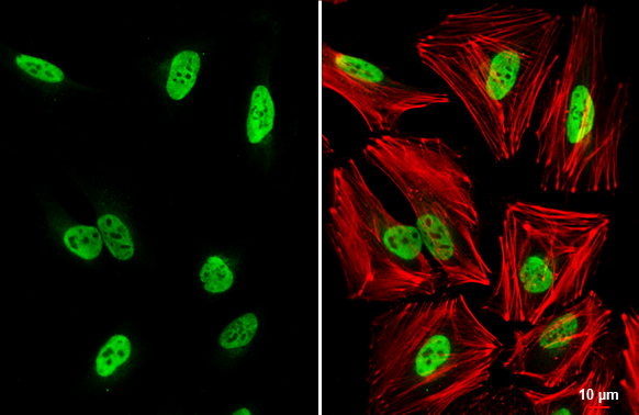 hnRNP A0 antibody detects hnRNP A0 protein at nucleus by immunofluorescent analysis. Sample: HeLa cells were fixed in 4% paraformaldehyde at RT for 15 min. Green: hnRNP A0 stained by hnRNP A0 antibody (GTX133398) diluted at 1:1000. Red: phalloidin, a cytoskeleton marker, diluted at 1:200. Scale bar= 10 μm.