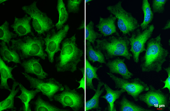 Anti-Human Papillomavirus type 18 E7 antibody (GTX133412