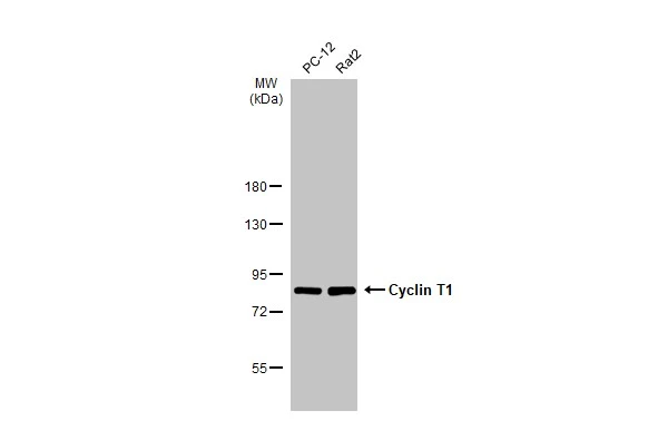 Various whole cell extracts (30 μg) were separated by 7.5% SDS-PAGE, and the membrane was blotted with Cyclin T1 antibody (GTX133413) diluted at 1:1000. The HRP-conjugated anti-rabbit IgG antibody (GTX213110-01) was used to detect the primary antibody.