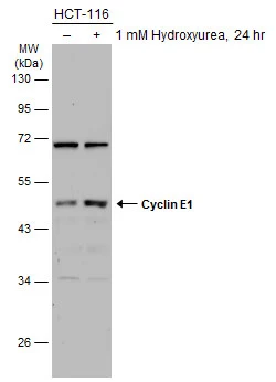 Untreated (–) and treated (+) HCT-116 whole cell extracts (30 μg) were separated by 10% SDS-PAGE, and the membrane was blotted with Cyclin E1 antibody (GTX133414) diluted at 1:2500. The HRP-conjugated anti-rabbit IgG antibody (GTX213110-01) was used to detect the primary antibody.