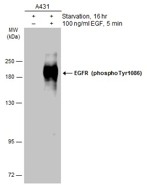Untreated (–) and treated (+) A431 whole cell extract (30 μg) were separated by 7.5% SDS-PAGE, and the membrane was blotted with EGFR (phospho Tyr1086) antibody (GTX133421) diluted at 1:2000. The HRP-conjugated anti-rabbit IgG antibody (GTX213110-01) was used to detect the primary antibody.