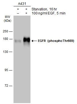 Untreated (–) and treated (+) A431 whole cell extract (30 μg) were separated by 7.5% SDS-PAGE, and the membrane was blotted with EGFR (phospho Thr669) antibody (GTX133425) diluted at 1:2000. The HRP-conjugated anti-rabbit IgG antibody (GTX213110-01) was used to detect the primary antibody.