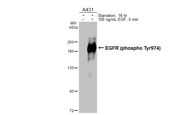 Untreated (–) and treated (+) A431 whole cell extracts (30 μg) were separated by 7.5% SDS-PAGE, and the membrane was blotted with EGFR (phospho Tyr974) antibody (GTX133427) diluted at 1:2000. The HRP-conjugated anti-rabbit IgG antibody (GTX213110-01) was used to detect the primary antibody.