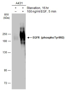 EGFR (phospho Tyr992) antibody