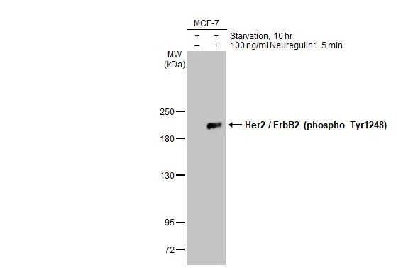 Untreated (–) and treated (+) MCF-7 whole cell extracts (30 μg) were separated by 5% SDS-PAGE, and the membrane was blotted with Her2 / ErbB2 (phospho Tyr1248) antibody (GTX133439) diluted at 1:1000. The HRP-conjugated anti-rabbit IgG antibody (GTX213110-01) was used to detect the primary antibody.