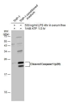 Treated (+) THP-1 whole cell extracts and conditioned medium (30 μg) were separated by 15% SDS-PAGE, and the membrane was blotted with Cleaved Caspase 1 (p20) antibody (GTX133447) diluted at 1:1000. The HRP-conjugated anti-rabbit IgG antibody (GTX213110-01) was used to detect the primary antibody.