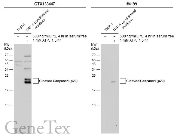 Untreated (–) and treated (+) THP-1 whole cell extracts and conditioned medium (30 μg) were separated by 15% SDS-PAGE, and the membranes were blotted with Caspase 1 (cleaved Asp297) antibody (GTX133447) diluted at 1:1000 and competitor's antibody (#4199) diluted at 1:1000. The HRP-conjugated anti-rabbit IgG antibody (GTX213110-01) was used to detect the primary antibody. *The competitor is not affiliated with GeneTex and does not endorse this product.