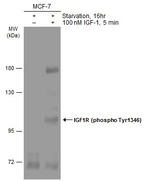 Untreated (–) and treated (+) MCF-7 whole cell extracts (60 μg) were separated by 7.5% SDS-PAGE, and the membrane was blotted with IGF1R beta (phospho Tyr1316) antibodyy (GTX133448) diluted at 1:1000. The HRP-conjugated anti-rabbit IgG antibody (GTX213110-01) was used to detect the primary antibody.
