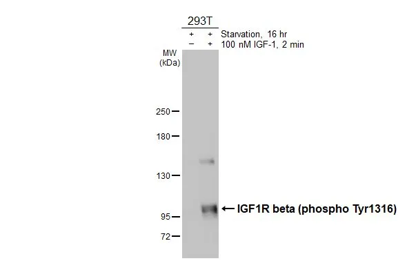 Untreated (–) and treated (+) 293T whole cell extracts (30 μg) were separated by 5% SDS-PAGE, and the membrane was blotted with IGF1R beta (phospho Tyr1316) antibody (GTX133448) diluted at 1:1000. The HRP-conjugated anti-rabbit IgG antibody (GTX213110-01) was used to detect the primary antibody.