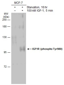 Untreated (–) and treated (+) MCF-7 whole cell extract (50 μg) were separated by 7.5% SDS-PAGE, and the membrane was blotted with IGF1R beta (phospho Tyr950) antibody (GTX133449) diluted at 1:1000. The HRP-conjugated anti-rabbit IgG antibody (GTX213110-01) was used to detect the primary antibody.