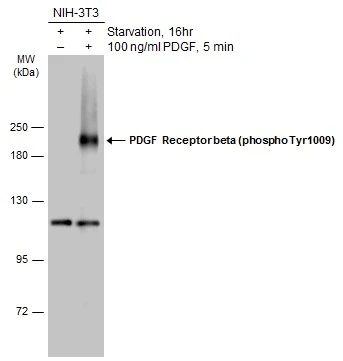 Untreated (–) and treated (+) NIH-3T3 whole cell extracts (30 μg) were separated by 7.5% SDS-PAGE, and the membrane was blotted with PDGF Receptor beta (phospho Tyr1009) antibody (GTX133453) diluted at 1:1000. The HRP-conjugated anti-rabbit IgG antibody (GTX213110-01) was used to detect the primary antibody.