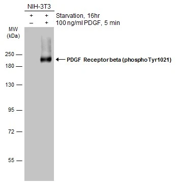 Untreated (–) and treated (+) NIH-3T3 whole cell extracts (30 μg) were separated by 7.5% SDS-PAGE, and the membrane was blotted with PDGF Receptor beta (phospho Tyr1021) antibody (GTX133454) diluted at 1:1000. The HRP-conjugated anti-rabbit IgG antibody (GTX213110-01) was used to detect the primary antibody.
