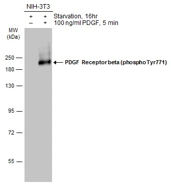Untreated (–) and treated (+) NIH-3T3 whole cell extracts (30 μg) were separated by 7.5% SDS-PAGE, and the membrane was blotted with PDGF Receptor beta (phospho Tyr771) antibody (GTX133456) diluted at 1:1000. The HRP-conjugated anti-rabbit IgG antibody (GTX213110-01) was used to detect the primary antibody.