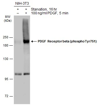 PDGF Receptor beta (phospho Tyr751) antibody