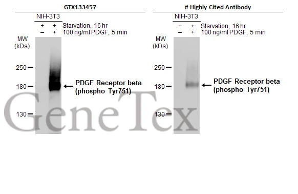 PDGF Receptor beta (phospho Tyr751) antibody