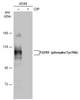 Untreated (–) and treated (+) A549 whole cell extracts (50 μg) were separated by 7.5% SDS-PAGE, and the membrane was blotted with FGFR1 (phospho Tyr766) antibody (GTX133459) diluted at 1:1000. The HRP-conjugated anti-rabbit IgG antibody (GTX213110-01) was used to detect the primary antibody.
