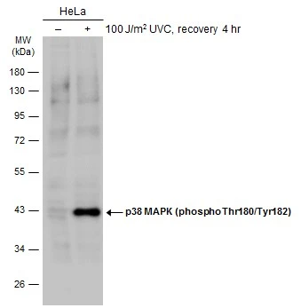 Untreated (–) and treated (+) HeLa whole cell extracts (30 μg) were separated by 10% SDS-PAGE, and the membrane was blotted with p38 MAPK (phospho Thr180/Tyr182) antibody (GTX133460) diluted at 1:1000. The HRP-conjugated anti-rabbit IgG antibody (GTX213110-01) was used to detect the primary antibody.