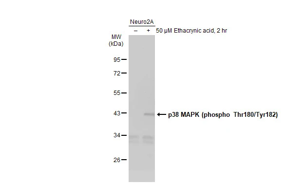 Untreated (–) and treated (+) Neuro2A whole cell extracts (30 μg) were separated by 10% SDS-PAGE, and the membrane was blotted with p38 MAPK (phospho Thr180/Tyr182) antibody (GTX133460) diluted at 1:1000. The HRP-conjugated anti-rabbit IgG antibody (GTX213110-01) was used to detect the primary antibody, and the signal was developed with Trident ECL plus-Enhanced.