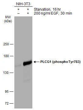 Untreated (–) and treated (+) NIH-3T3 whole cell extracts (30 μg) were separated by 5% SDS-PAGE, and the membrane was blotted with PLCG1 (phospho Tyr783) antibody (GTX133465) diluted at 1:1000. The HRP-conjugated anti-rabbit IgG antibody (GTX213110-01) was used to detect the primary antibody.