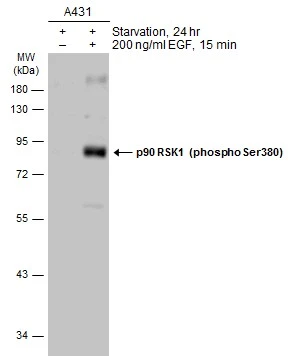 Untreated (–) and treated (+) A431 whole cell extracts (30 μg) were separated by 10% SDS-PAGE, and the membrane was blotted with p90 RSK1 (phospho Ser380) antibody (GTX133467) diluted at 1:1000. The HRP-conjugated anti-rabbit IgG antibody (GTX213110-01) was used to detect the primary antibody. Untreated (–) and treated (+) A431 whole cell extracts (30 μg) were separated by 10% SDS-PAGE, and the membrane was blotted with p90 RSK1 (phospho Ser380) antibody (GTX133467) diluted at 1:1000. The HRP-conjugated anti-rabbit IgG antibody (GTX213110-01) was used to detect the primary antibody.