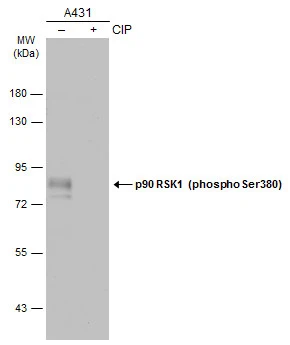 Untreated (–) and treated (+) A431 whole cell extracts (30 μg) were separated by 7.5% SDS-PAGE, and the membrane was blotted with p90 RSK1 (phospho Ser380) antibody (GTX133467) diluted at 1:500. The HRP-conjugated anti-rabbit IgG antibody (GTX213110-01) was used to detect the primary antibody. Untreated (–) and treated (+) A431 whole cell extracts (30 μg) were separated by 7.5% SDS-PAGE, and the membrane was blotted with p90 RSK1 (phospho Ser380) antibody (GTX133467) diluted at 1:500. The HRP-conjugated anti-rabbit IgG antibody (GTX213110-01) was used to detect the primary antibody.