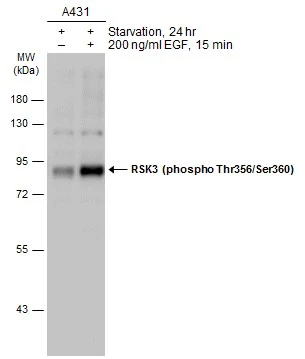Untreated (–) and treated (+) A431 whole cell extracts (30 μg) were separated by 10% SDS-PAGE, and the membrane was blotted with RSK3 (phospho Thr356/Ser360) antibody (GTX133480) diluted at 1:1000. The HRP-conjugated anti-rabbit IgG antibody (GTX213110-01) was used to detect the primary antibody.