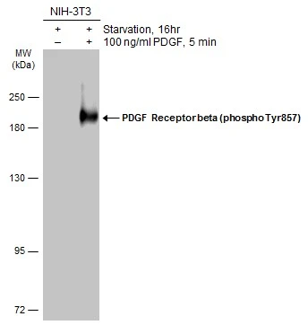 PDGF Receptor beta (phospho Tyr857) antibody