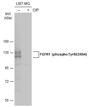 FGFR1 (phospho Tyr653/654) antibody