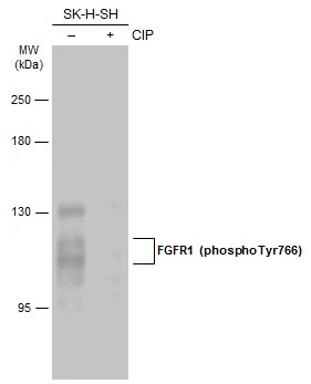FGFR1 (phospho Tyr766) antibody