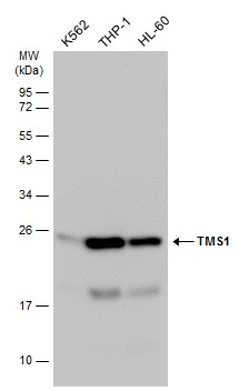 Various whole cell extracts (30 μg) were separated by 12% SDS-PAGE, and the membrane was blotted with TMS1 antibody (GTX133561) diluted at 1:1000. The HRP-conjugated anti-rabbit IgG antibody (GTX213110-01) was used to detect the primary antibody.