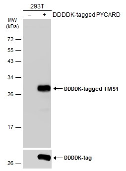 Non-transfected (–) and transfected (+) 293T whole cell extracts (30 μg) were separated by 12% SDS-PAGE, and the membrane was blotted with TMS1 antibody (GTX133561) diluted at 1:1000. The HRP-conjugated anti-rabbit IgG antibody (GTX213110-01) was used to detect the primary antibody.