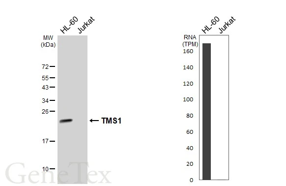 Various whole cell extracts (30 μg) were separated by 12% SDS-PAGE, and the membrane was blotted with TMS1 antibody (GTX133561) diluted at 1:1000. The HRP-conjugated anti-rabbit IgG antibody (GTX213110-01) was used to detect the primary antibody. Corresponding RNA expression data for the same cell lines are based on Human Protein Atlas program.