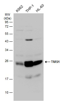 Various whole cell extracts (30 μg) were separated by 12% SDS-PAGE, and the membrane was blotted with TMS1 antibody (GTX133581) diluted at 1:1000. The HRP-conjugated anti-rabbit IgG antibody (GTX213110-01) was used to detect the primary antibody.
