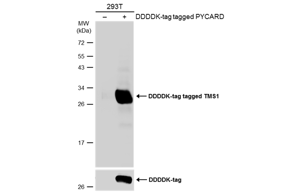 Non-transfected (–) and transfected (+) 293T whole cell extracts (30 μg) were separated by 12% SDS-PAGE, and the membrane was blotted with TMS1 antibody (GTX133581) diluted at 1:5000. The HRP-conjugated anti-rabbit IgG antibody (GTX213110-01) was used to detect the primary antibody.