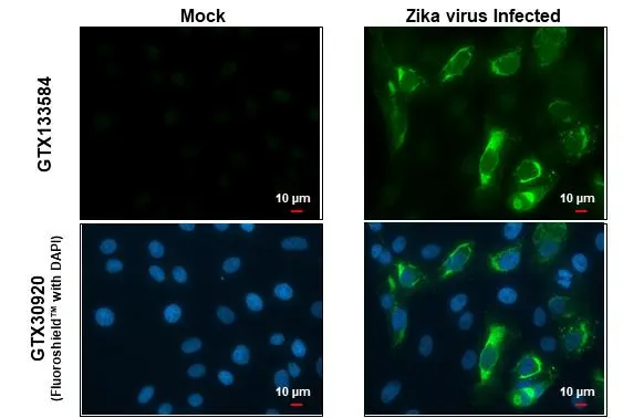 Immunofluorescent analysis of arboviruses infected cells using Zika virus prM protein antibody (GTX133584). Sample: Mock and zika virus-infected cells. Green: Zika virus prM protein antibody (GTX133584) diluted at 1:100.
