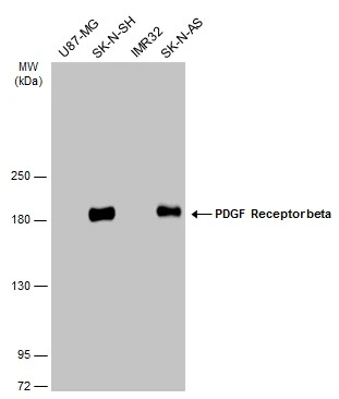 PDGF Receptor beta antibody