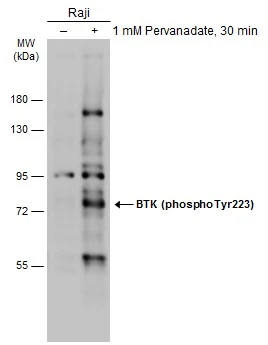 Untreated (–) and treated (+) Raji whole cell extracts (30 μg) were separated by 7.5% SDS-PAGE, and the membrane was blotted with BTK (phospho Tyr223) antibody (GTX133591) diluted at 1:1000. The HRP-conjugated anti-rabbit IgG antibody (GTX213110-01) was used to detect the primary antibody.