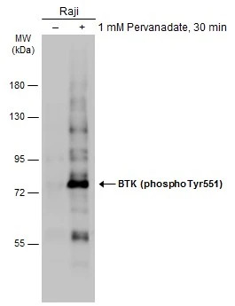 Untreated (–) and treated (+) Raji whole cell extracts (30 μg) were separated by 7.5% SDS-PAGE, and the membrane was blotted with BTK (phospho Tyr551) antibody (GTX133592) diluted at 1:1000. The HRP-conjugated anti-rabbit IgG antibody (GTX213110-01) was used to detect the primary antibody.