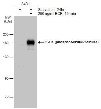 EGFR (phospho Ser1046/Ser1047) antibody