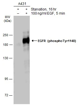 EGFR (phospho Tyr1148) antibody
