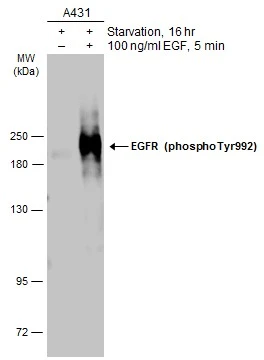 EGFR (phospho Tyr992) antibody