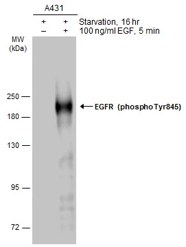 EGFR (phospho Tyr845) antibody