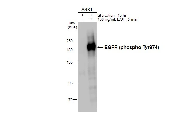 EGFR (phospho Tyr974) antibody