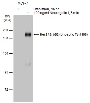Untreated (–) and treated (+) MCF-7 whole cell extracts (30 μg) were separated by 7.5% SDS-PAGE, and the membrane was blotted with Her2 / ErbB2 (phospho Tyr1196) antibody (GTX133602) diluted at 1:1000. The HRP-conjugated anti-rabbit IgG antibody (GTX213110-01) was used to detect the primary antibody.