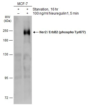 Her2 / ErbB2 (phospho Tyr877) antibody