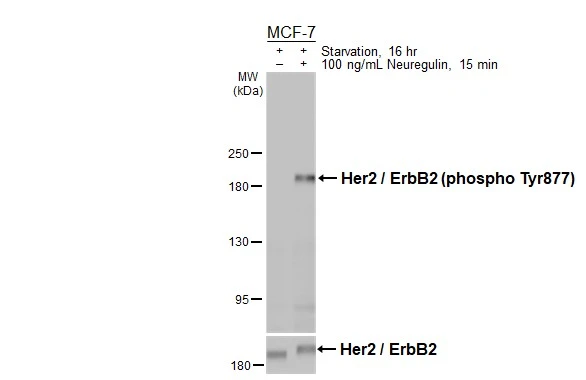Untreated (–) and treated (+) MCF-7 whole cell extract (30 μg) were separated by 5% SDS-PAGE, and the membranes were blotted with Her2 / ErbB2 (phospho Tyr877) antibody (GTX133605) diluted at 1:1000 and Her2 / ErbB2 antibody (GTX100509) diluted at 1:2000. The HRP-conjugated anti-rabbit IgG antibody (GTX213110-01) was used to detect the primary antibody, and the signal was developed with Trident ECL plus-Enhanced.