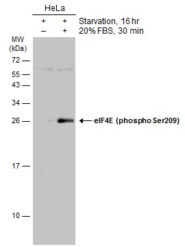 Untreated (–) and treated (+) HeLa whole cell extracts (30 μg) were separated by 15% SDS-PAGE, and the membrane was blotted with eIF4E (phospho Ser209) antibody (GTX133606) diluted at 1:1000. The HRP-conjugated anti-rabbit IgG antibody (GTX213110-01) was used to detect the primary antibody. Untreated (–) and treated (+) HeLa whole cell extracts (30 μg) were separated by 15% SDS-PAGE, and the membrane was blotted with eIF4E (phospho Ser209) antibody (GTX133606) diluted at 1:1000. The HRP-conjugated anti-rabbit IgG antibody (GTX213110-01) was used to detect the primary antibody.